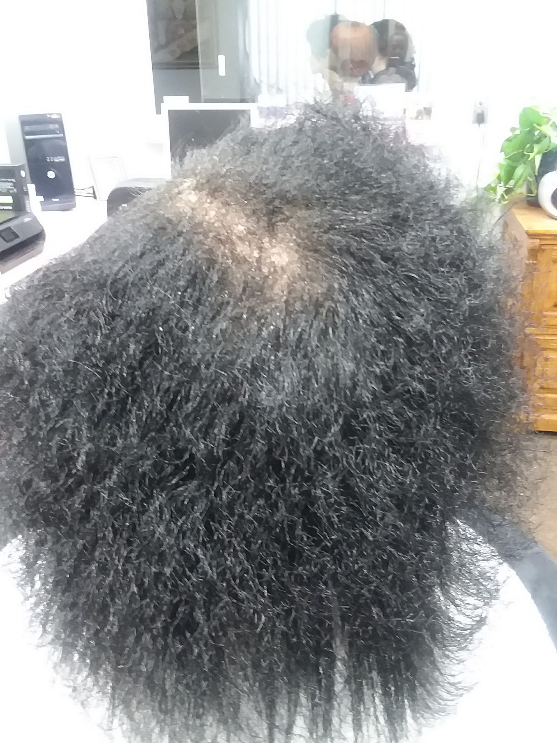 Hairloss-9-months-Growth-scaled